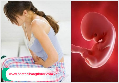 Nguyên nhân thai lưu và cách xử lý phù hợp